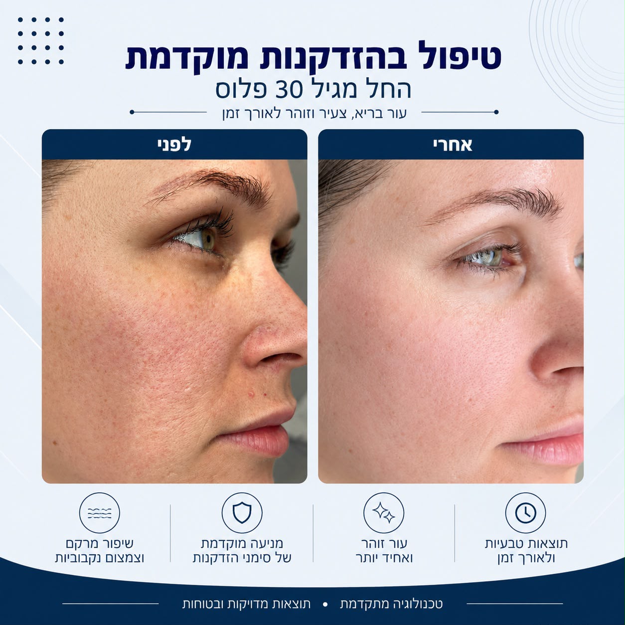 לפני ואחרי טיפול בהזדקנות מוקדמת מגיל 30 פלוס - Beauty Hightech
