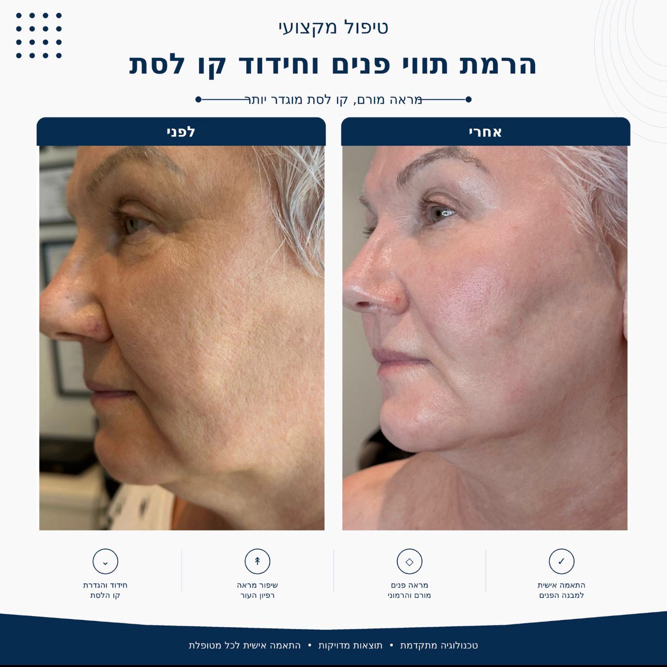 לפני ואחרי הרמת תווי פנים וחידוד קו לסת - Beauty Hightech