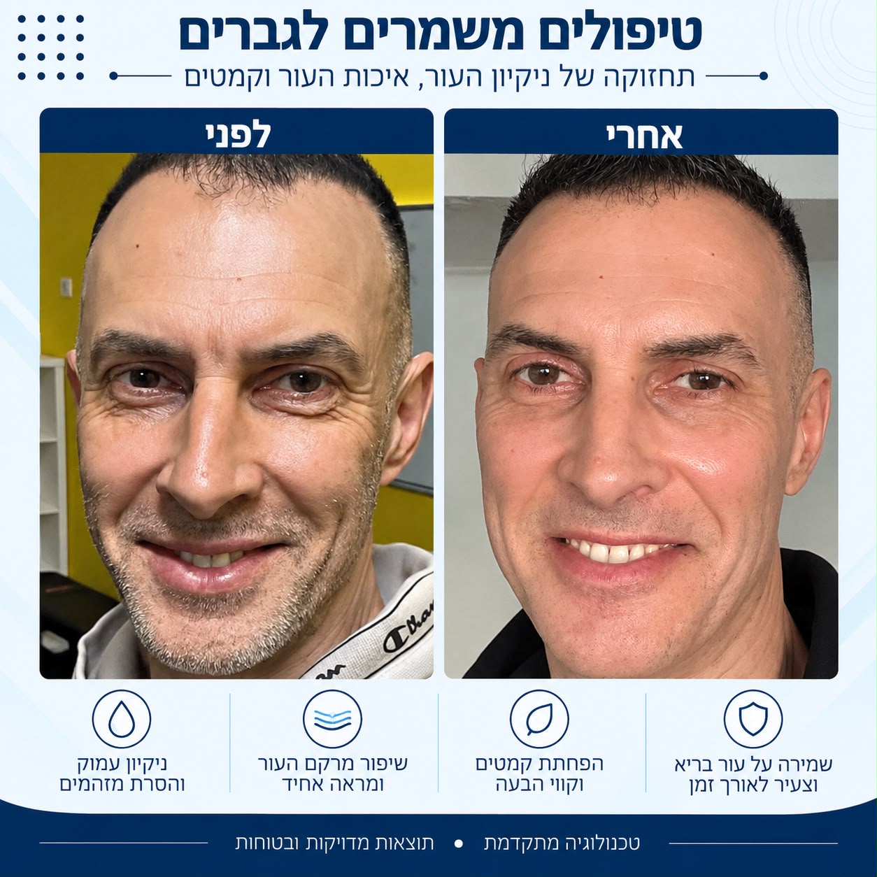 לפני ואחרי טיפולים משמרים לגברים - Beauty Hightech