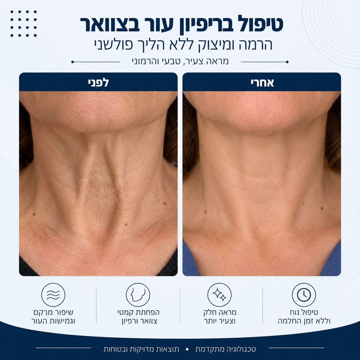 לפני ואחרי טיפול ברפיון עור בצוואר - Beauty Hightech