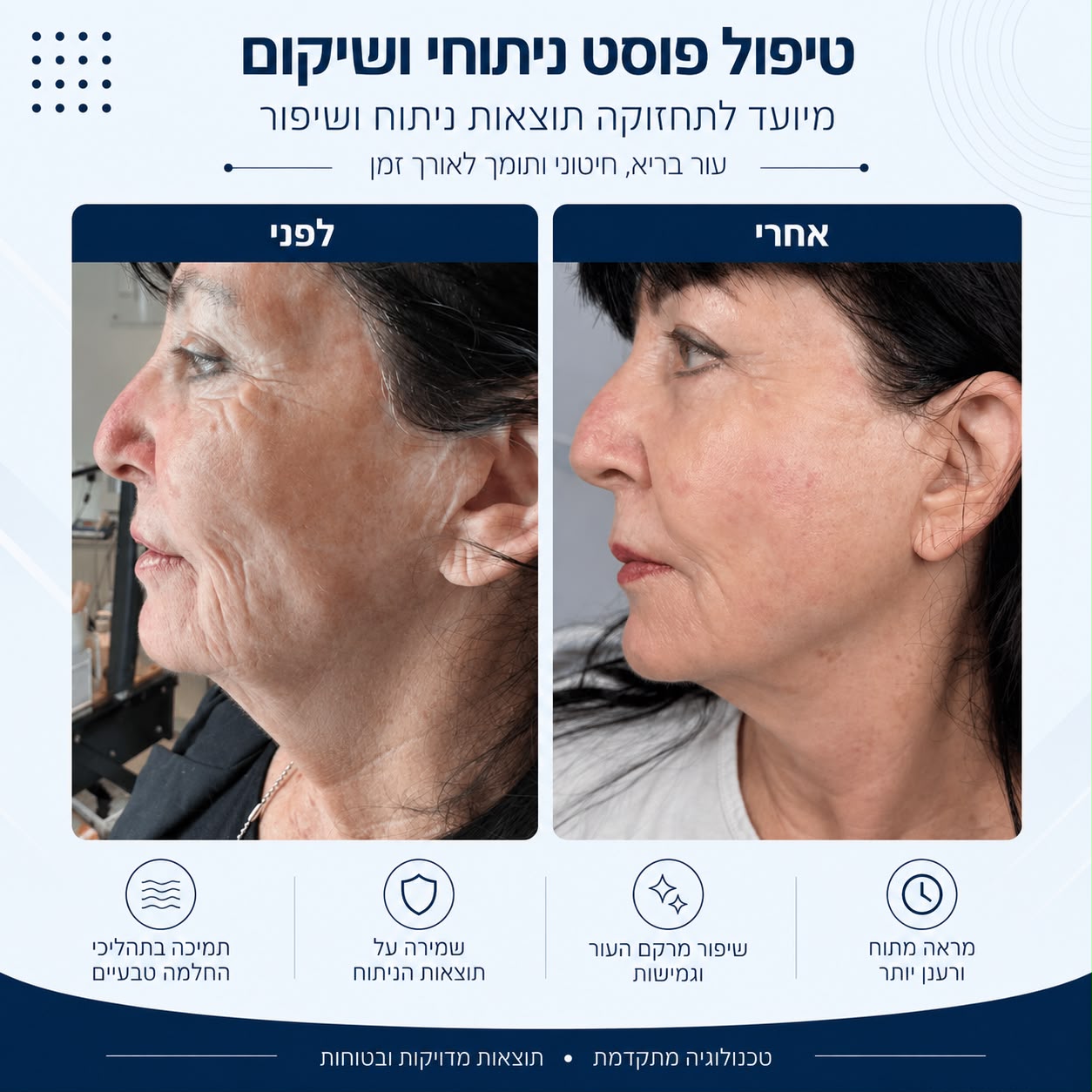 לפני ואחרי טיפול פוסט ניתוחי ושיקום - Beauty Hightech