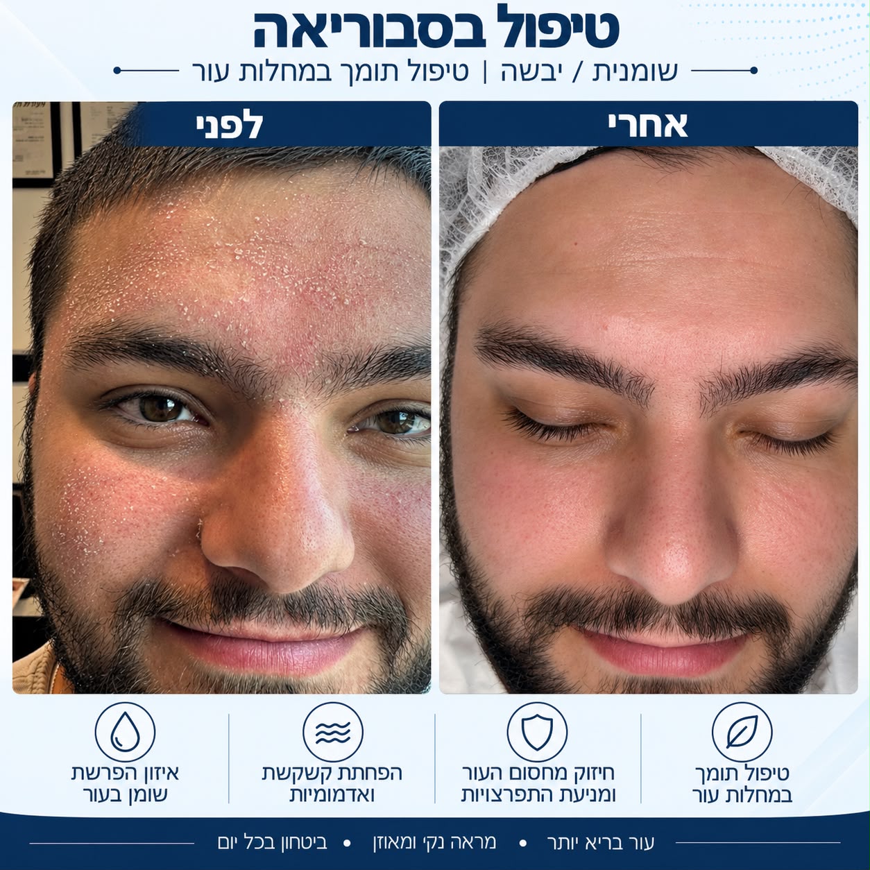 לפני ואחרי טיפול בסבוריאה - Beauty Hightech