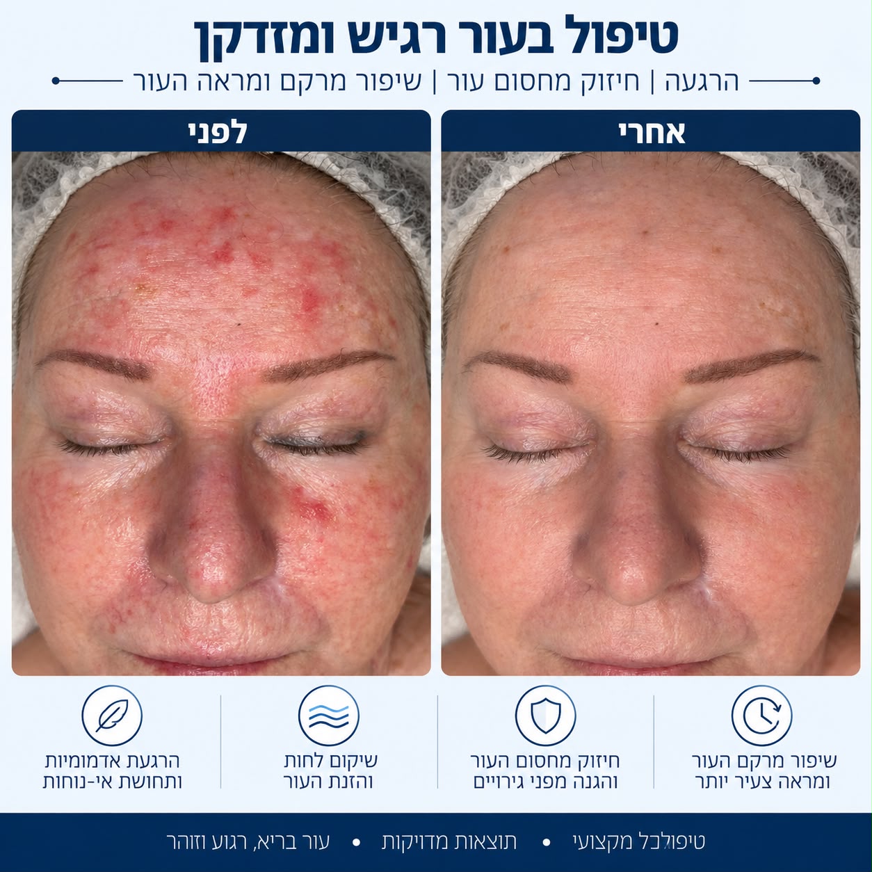 לפני ואחרי טיפול בעור רגיש ומזדקן - Beauty Hightech