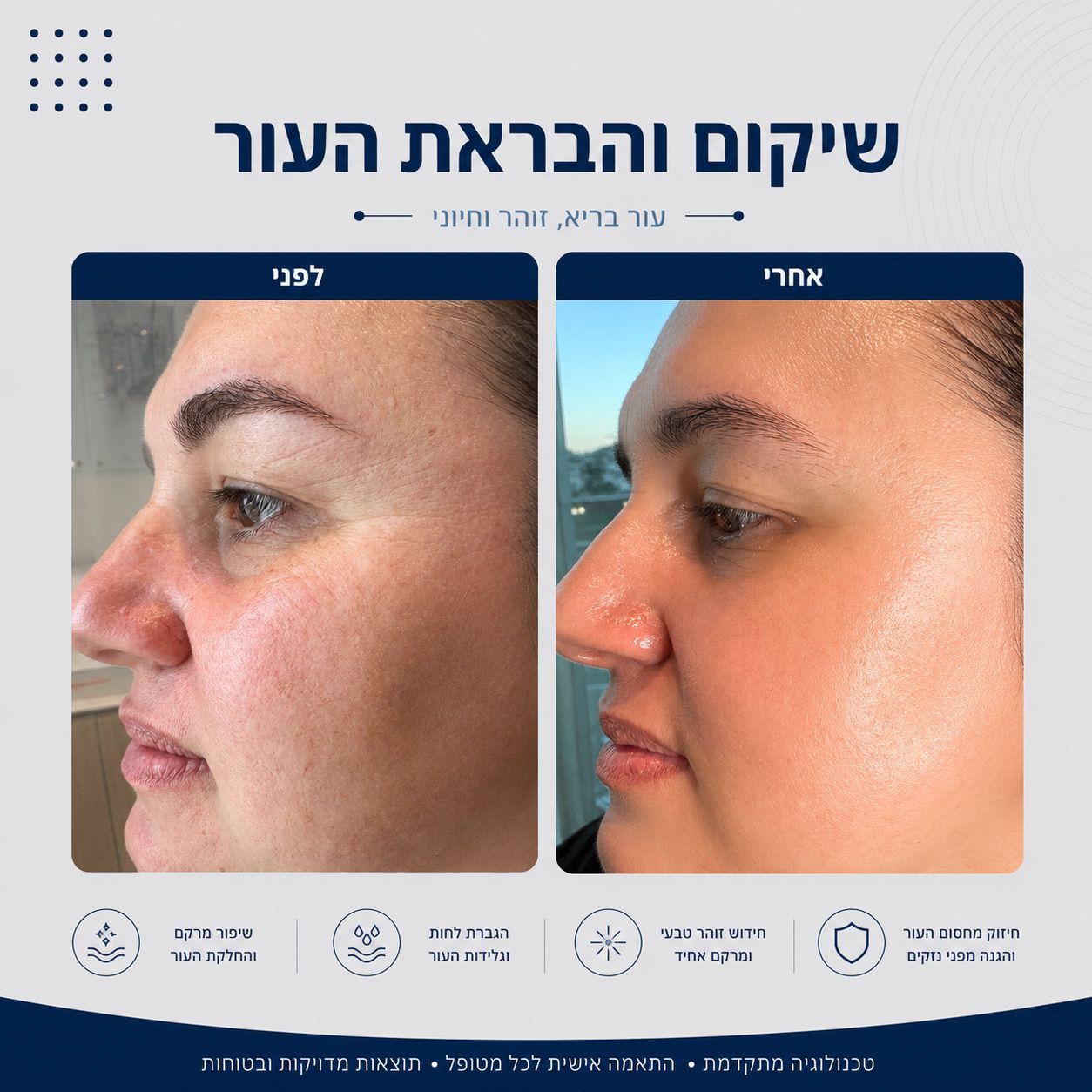לפני ואחרי שיקום והבראת העור - Beauty Hightech
