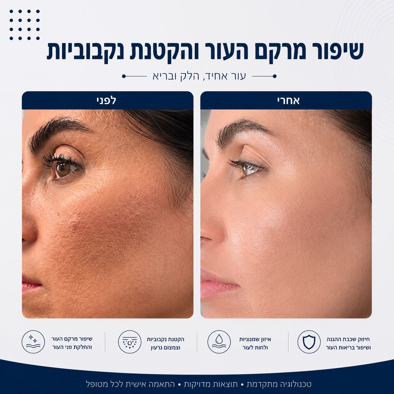 לפני ואחרי שיפור מרקם העור והקטנת נקבוביות - Beauty Hightech