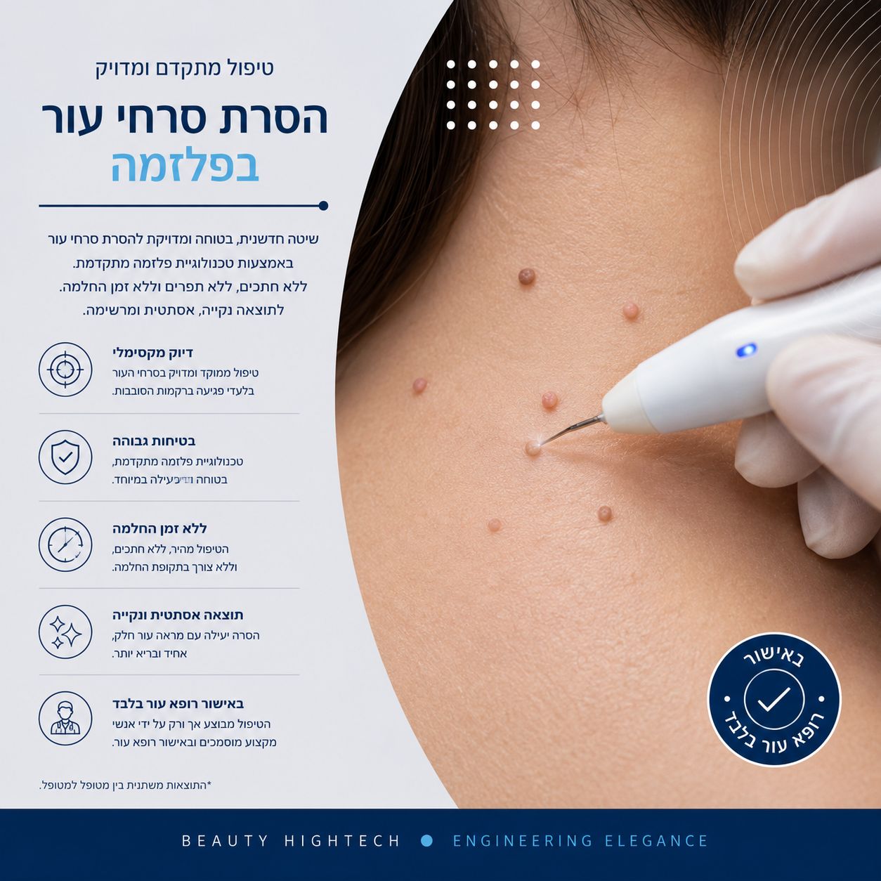 הסרת סרחי עור בפלזמה - Beauty Hightech